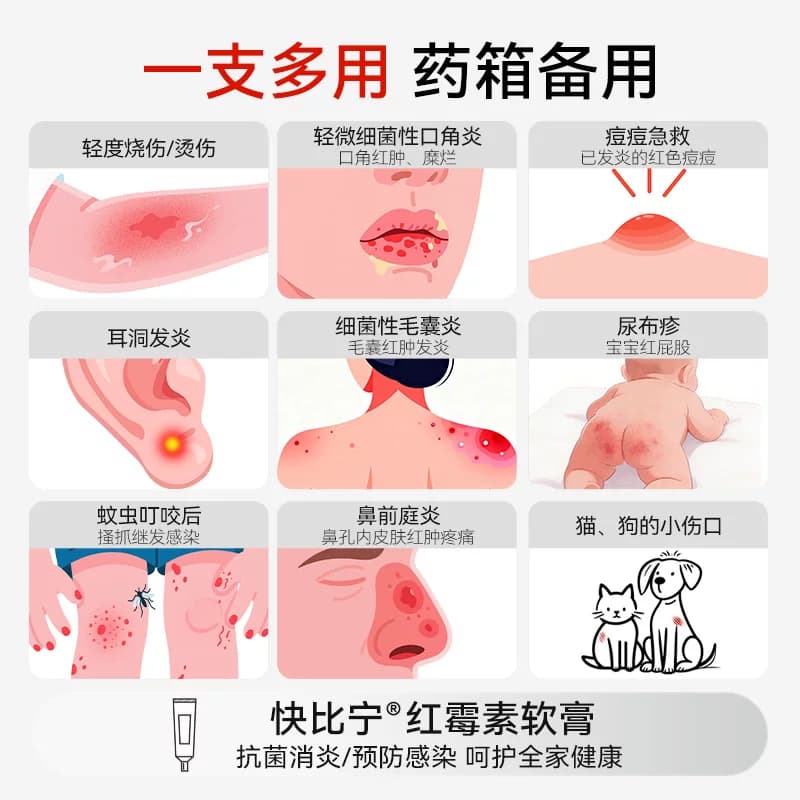 红霉素膏软膏外用官方旗舰店正品罗药痔疮消炎止痒婴儿私处祛痘印 - 缩略图2