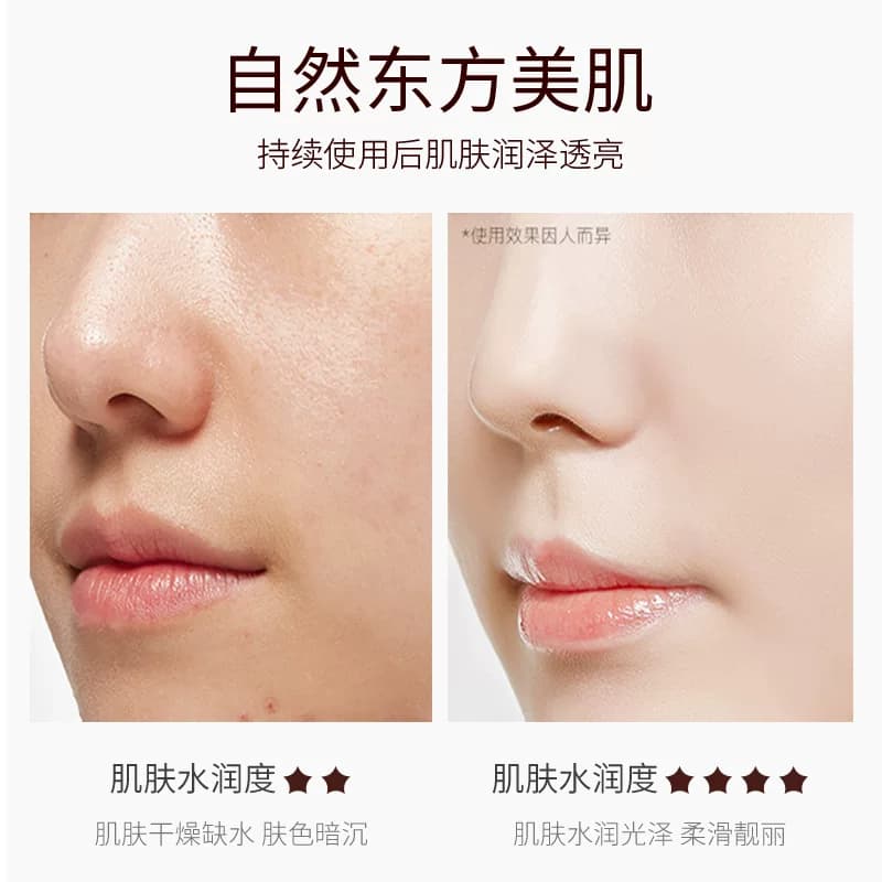 JLISA肌琳莎 烟酰胺玻尿酸蜗牛爽肤水乳bb眼霜面部护理套装男女士 - 缩略图5