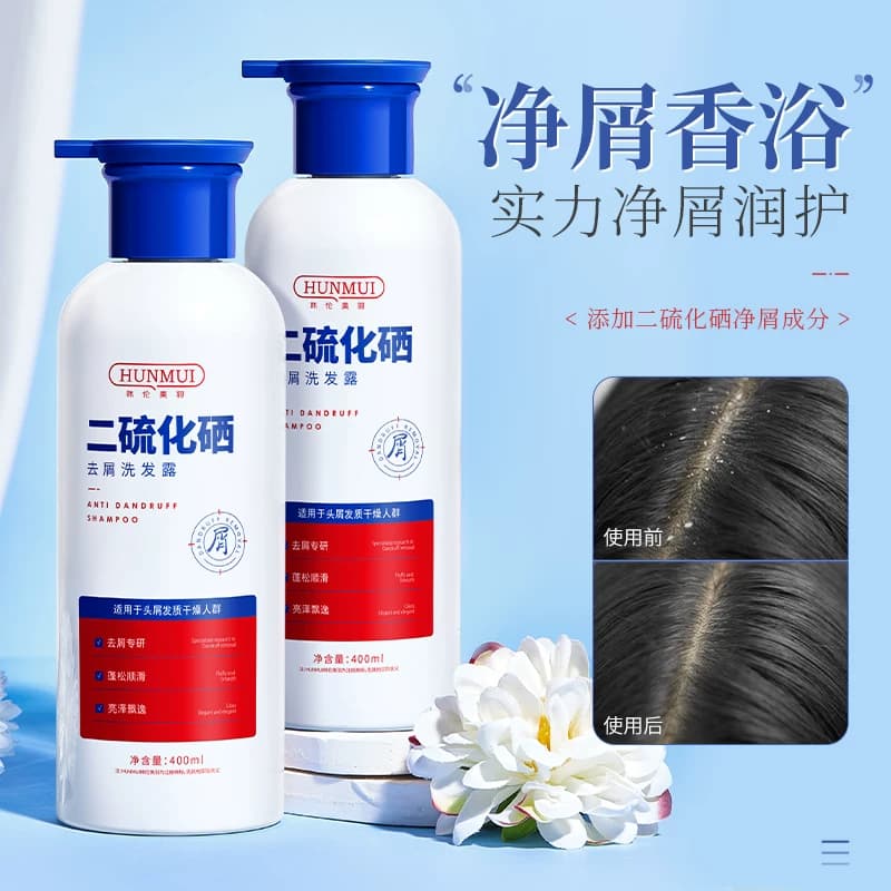 二硫化硒去屑洗发水液头皮毛囊清洁止痒洗头控油蓬松膏炎持久留香 - 缩略图3