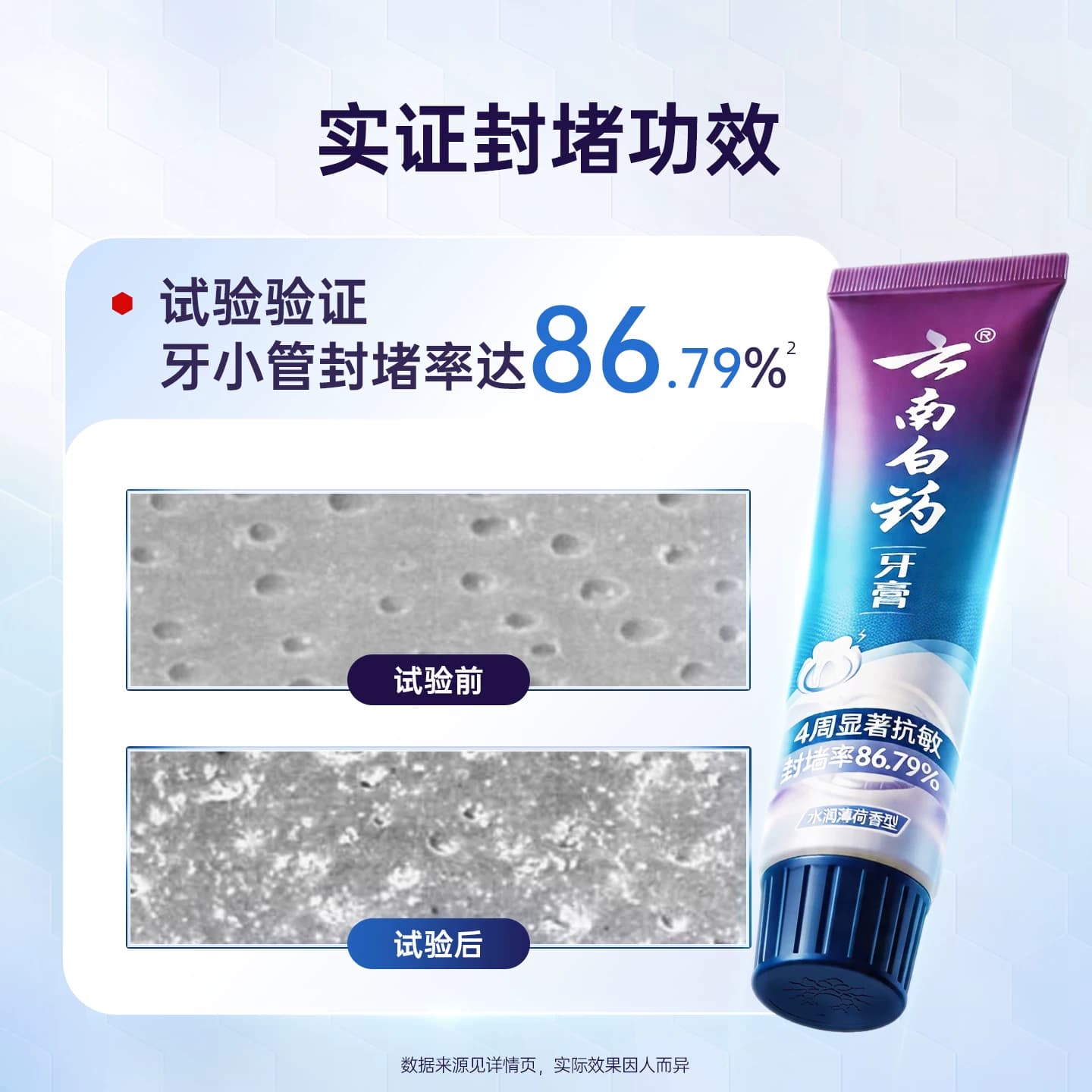 云南白药双效抗敏感牙膏薄荷缓解牙敏感护龈旗舰店官方正品150g - 缩略图3