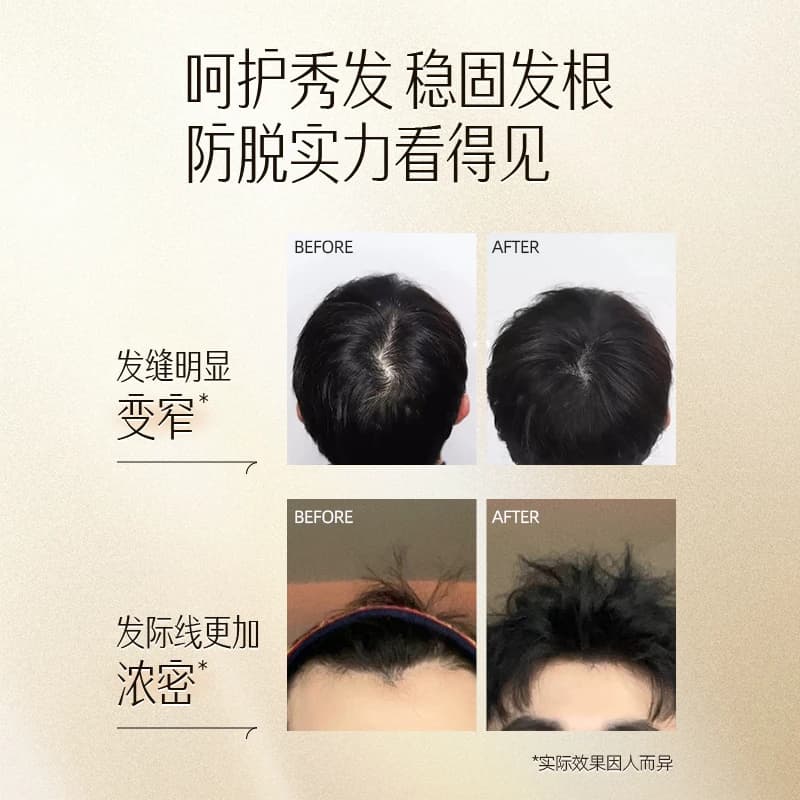 云南白药养元青洗发水强根健发短发固发防脱清爽控油大瓶装500ml - 缩略图4