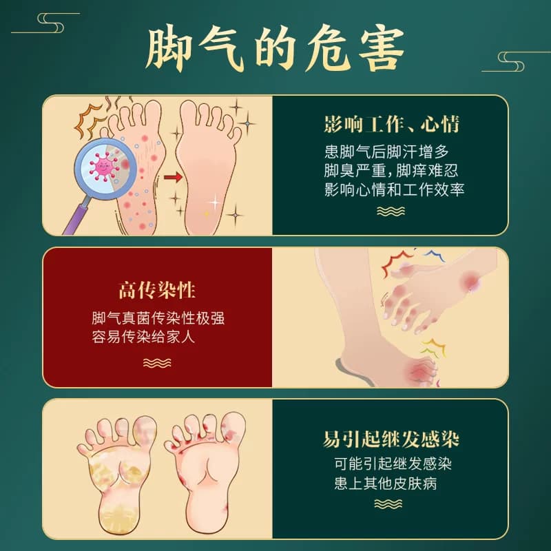九芝堂足光散正品脚气药止痒去脚臭脚气泡脚汗脚脱皮杀菌足光粉 - 缩略图3