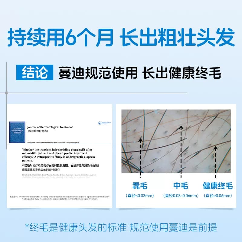 第二代米诺地尔蔓迪生发泡沫剂男女士快速防脱生发非液官方旗舰店 - 缩略图5