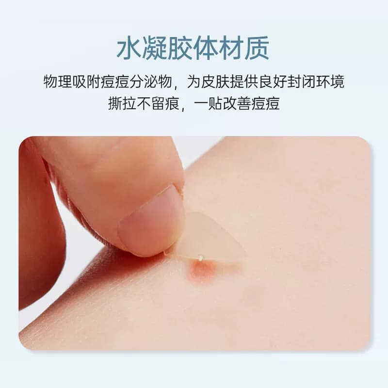 oliveyoung欧利芙洋痘痘贴隐形轻薄祛痘男女可上妆102痘贴经典款 - 缩略图4