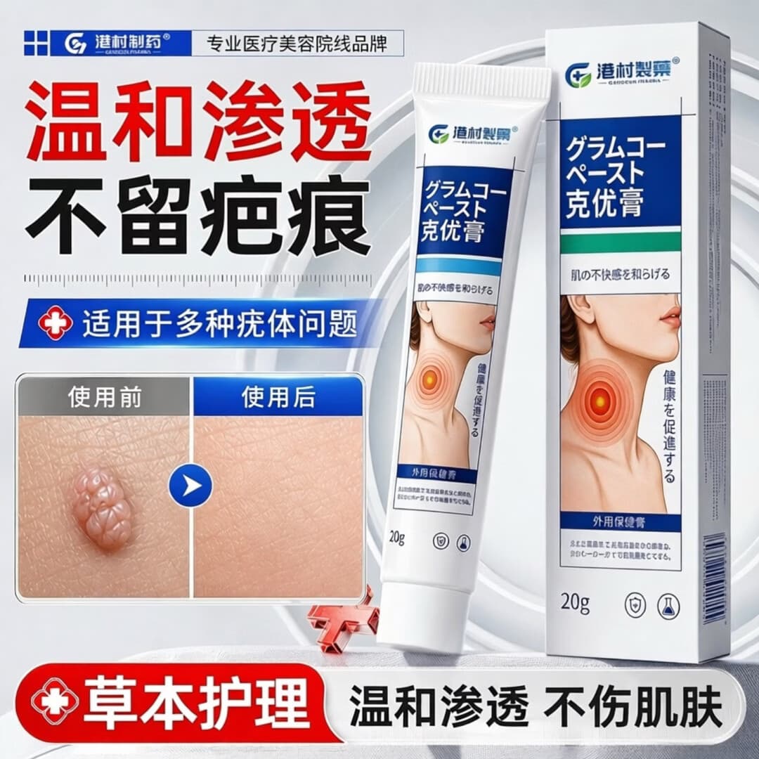港村制药疣扁平去除软膏疣瘊肉粒一抹灵无忧小肉粒疣丝状专用神器 2支周期装【深层拔除 无痛无痕】98%顾客选购