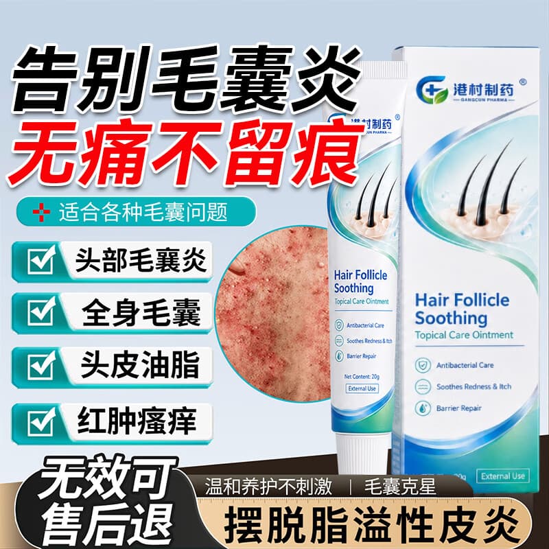 港村制药毛囊宁头上疙瘩头部毛囊头部脸部前胸后背脓包疙瘩痘痘软膏 2支周期装【轻重度适用】98%顾客选购