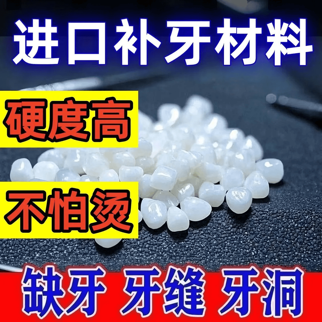 【升级款】补牙材料补缺牙自己动手高硬度补牙材料树脂医用美护z 【原装正品】药房同款 无效包退