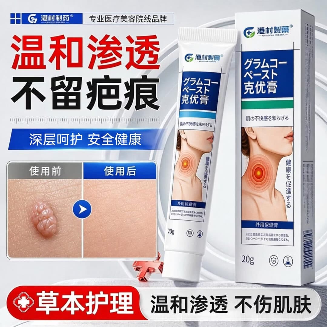 港村制药克疣膏草本护理温和渗透不伤皮肤官方正品 2支周期装【深层拔除 无痛无痕】98%顾客选购