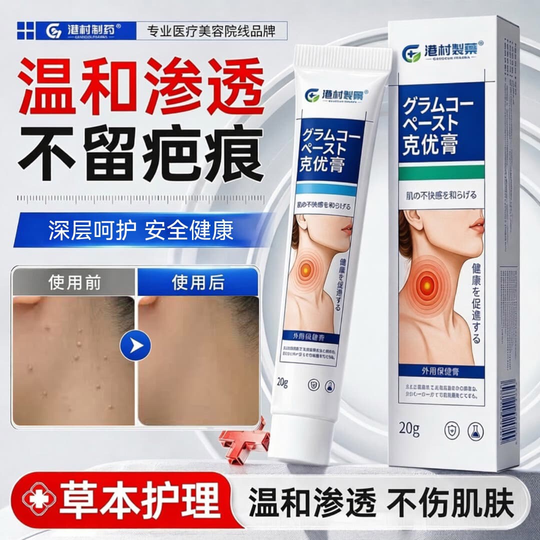 港村制药疣扁平去除软膏疣瘊肉粒一抹灵无忧小肉粒疣丝状专用神器 2支周期装【一抹无疣 无痛无痕】98%顾客选购